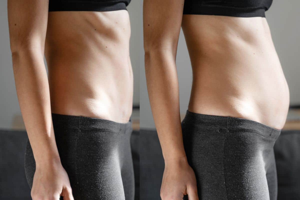 How long does diastasis recti take to improve Ilkeston?