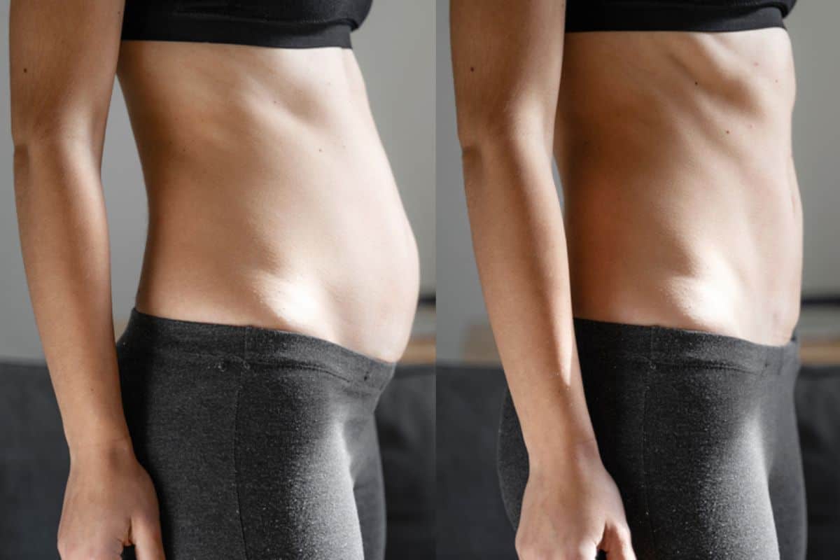 Post-Pregnancy: What Happens to Your Abdominal Muscles After Birth Ilkeston