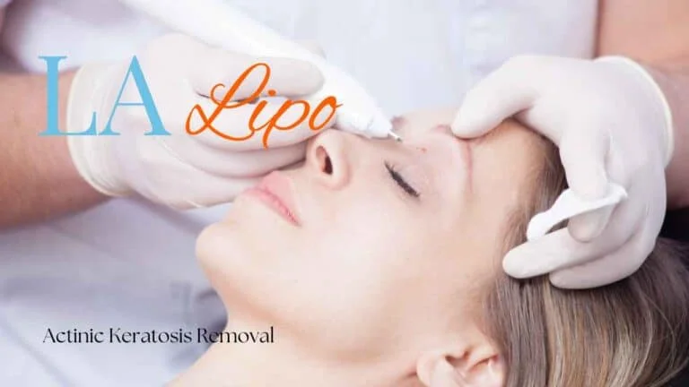 Woman receiving Actinic Keratosis Removal Treatment Ilkeston