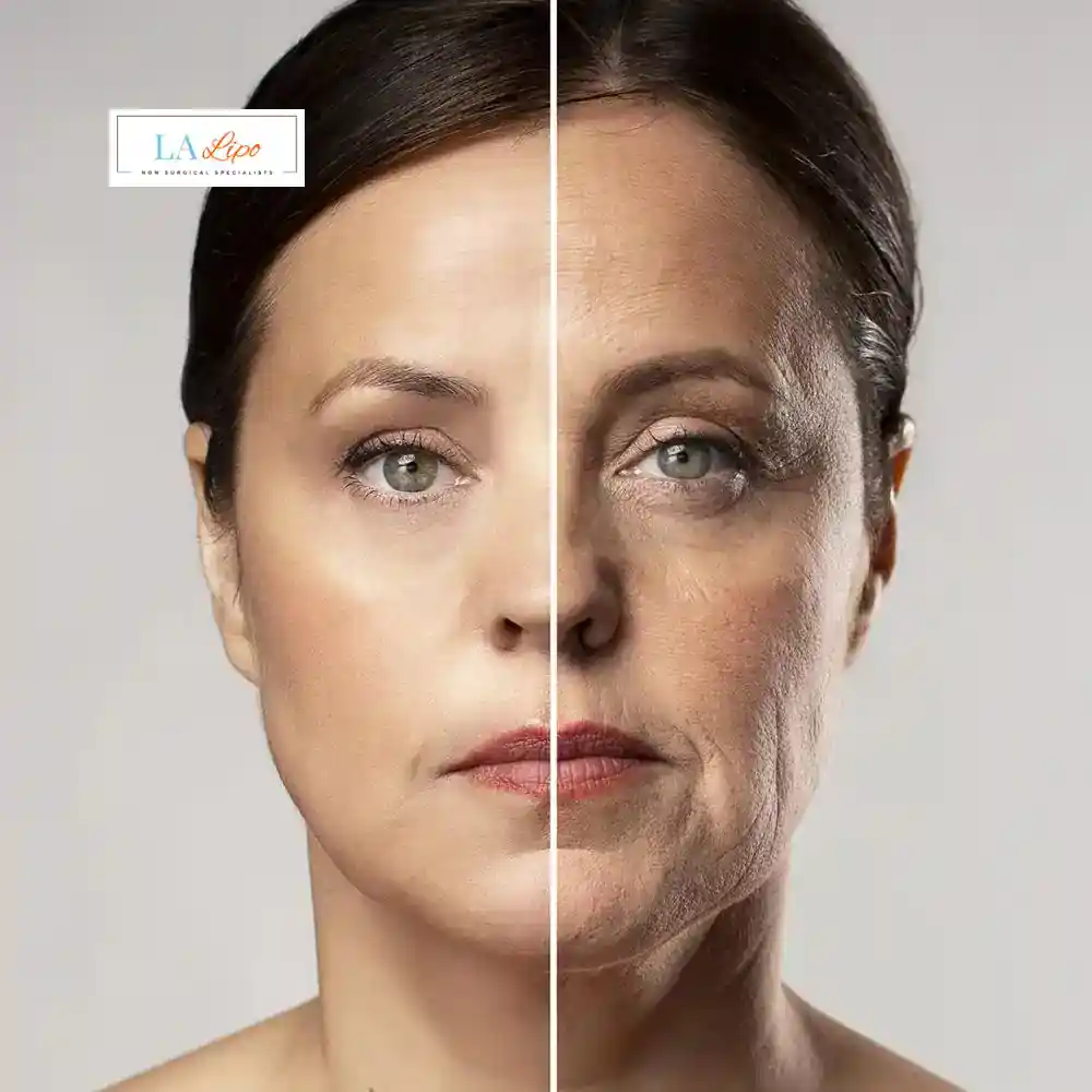 How Can You Tell If Non-Surgical Skin Tightening Is Right for You Ilkeston?