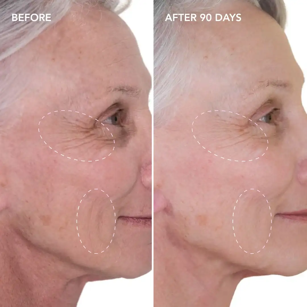 When will you see results Ilkeston
